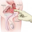 Prostate Diagram